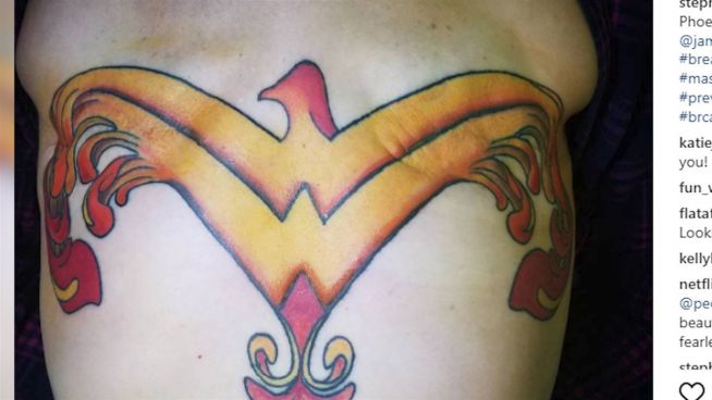 Nach Brustentfernung: Wonder-Woman-Tattoo zeigt Stärke