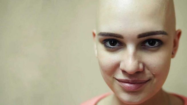 Mit erhobenem Glatzkopf: Mädchen aus Russland hat Mut