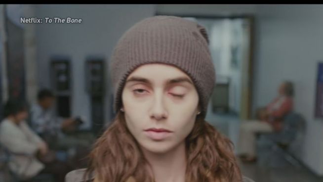 Abgemagert: Lily Collins im Trailer zu 'To the Bone'